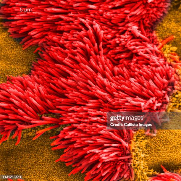 scanning electron micrograph of lung trachea - respiratory epithelium imagens e fotografias de stock