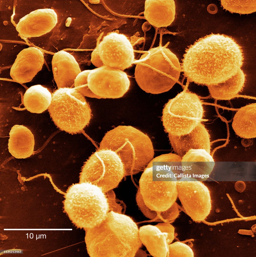 Scanning electron micrograph of algae