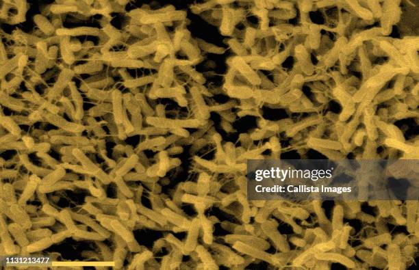 sem of clostridium difficile bacteria - clostridium difficile stock pictures, royalty-free photos & images