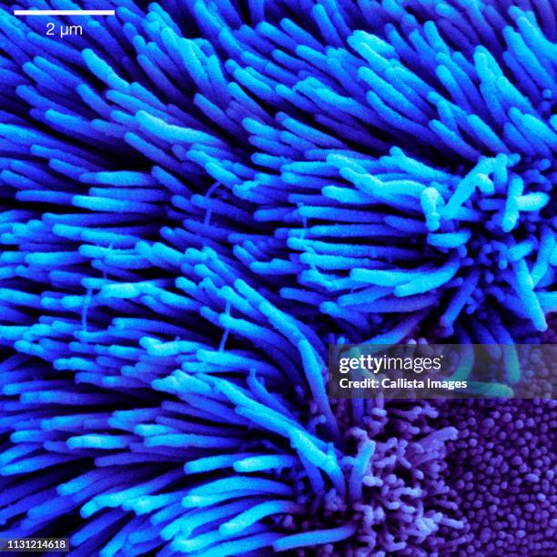 scanning electron micrograph of lung trachea - cilium stock pictures, royalty-free photos & images