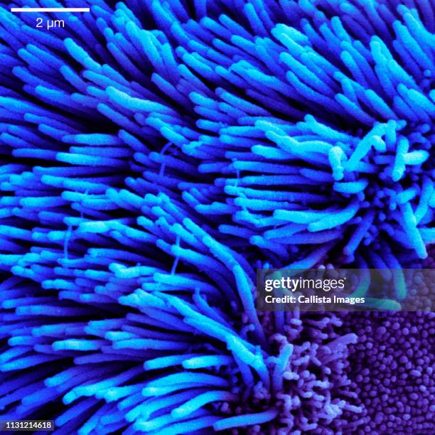 scanning electron micrograph of lung trachea - epitelio imagens e fotografias de stock