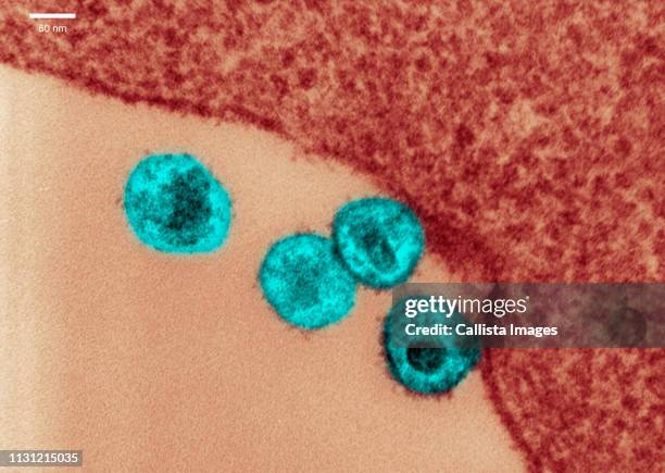 transmission electron micrograph of hiv - tem 個照片及圖片檔