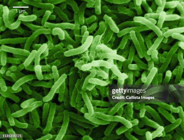 scanning electron micrograph of cholera bacteria - コレラ菌 ストックフォトと画像