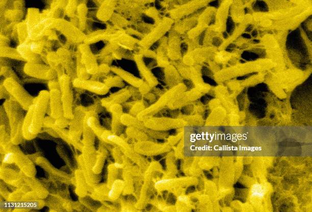 sem of clostridium difficile bacteria - clostridium difficile stock pictures, royalty-free photos & images