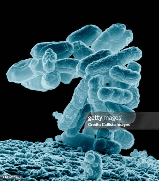 sem of a cluster of e. coli bacteria - escherichia coli stock-fotos und bilder