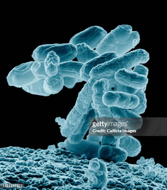 sem of a cluster of e. coli bacteria - microscopio elettronico a scansione foto e immagini stock