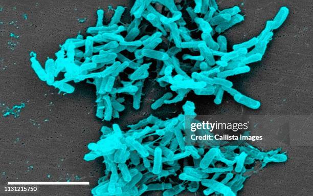 sem of clostridium difficile bacteria - clostridium difficile stock pictures, royalty-free photos & images