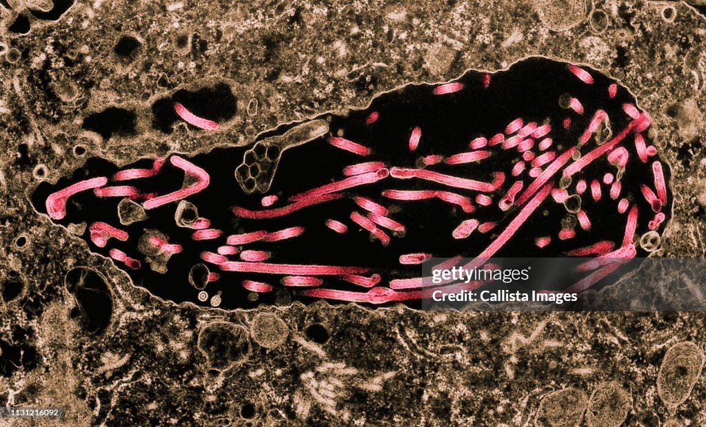 Transmission Electron micrograph of Ebola virus