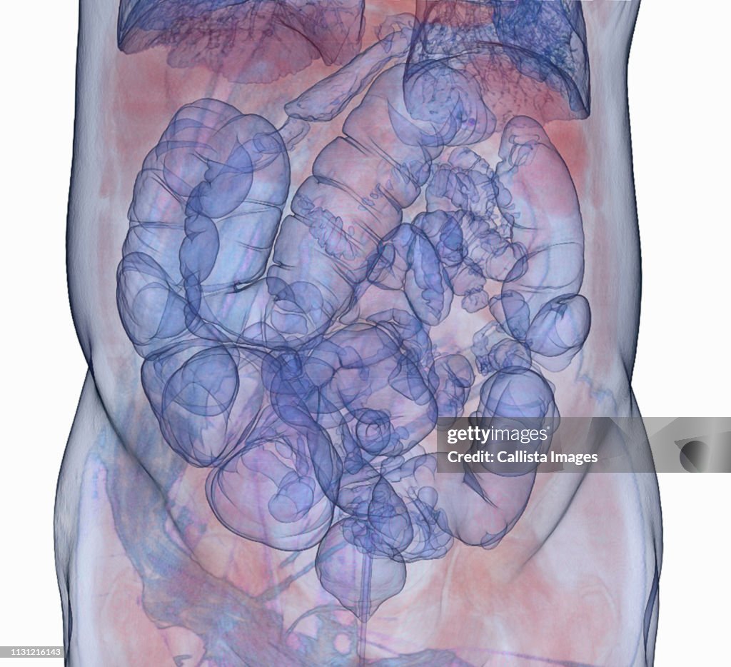 Colonoscopy Python 3d 3d Ct Scan Colonography Virtual Colonoscopy High-Res Stock Photo ...