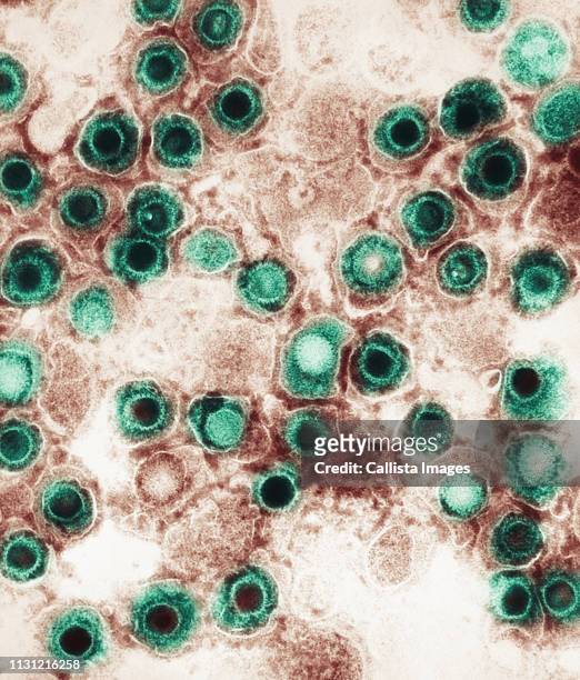 electron micrograph, herpes virus - herpes labial - fotografias e filmes do acervo