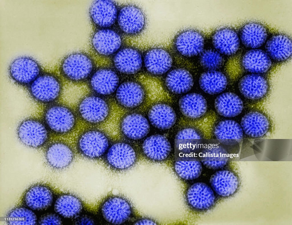 Transmission Electron micrograph of rotavirus