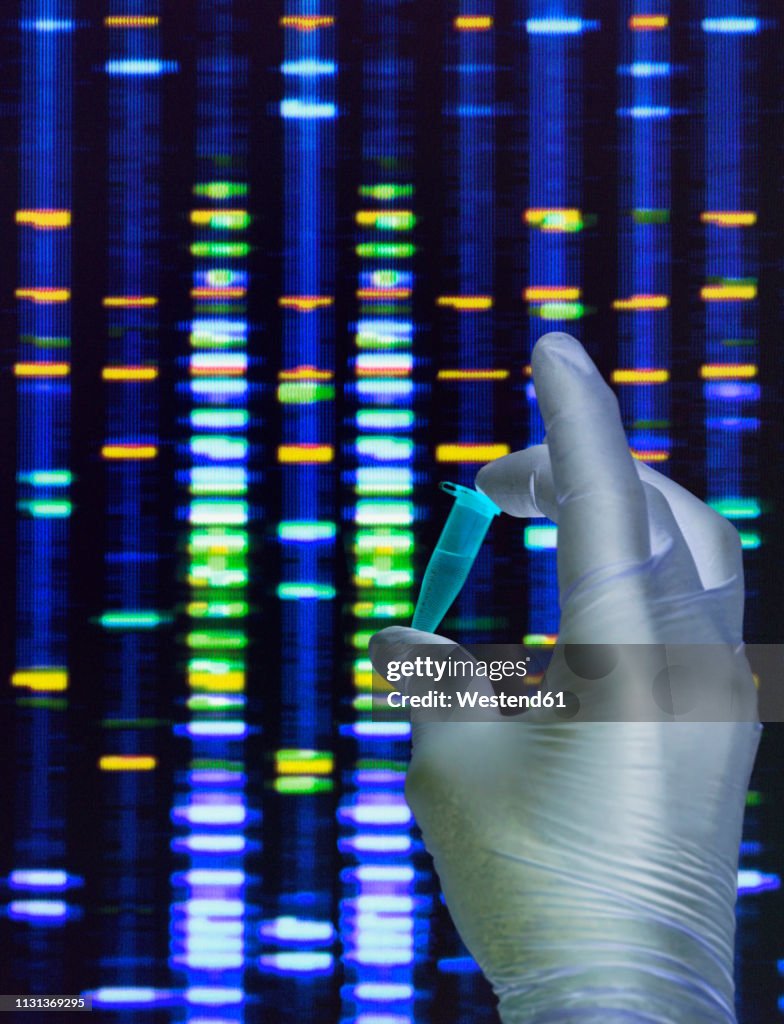Dna Samples Computer Scientist Holding A Dna Sample With The Results On A Computer Sceeen In ...