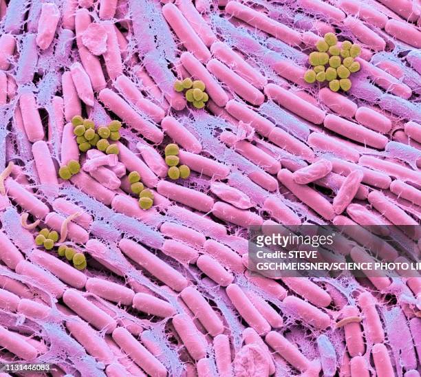 Intestinal Bacteria Photos and Premium High Res Pictures - Getty Images