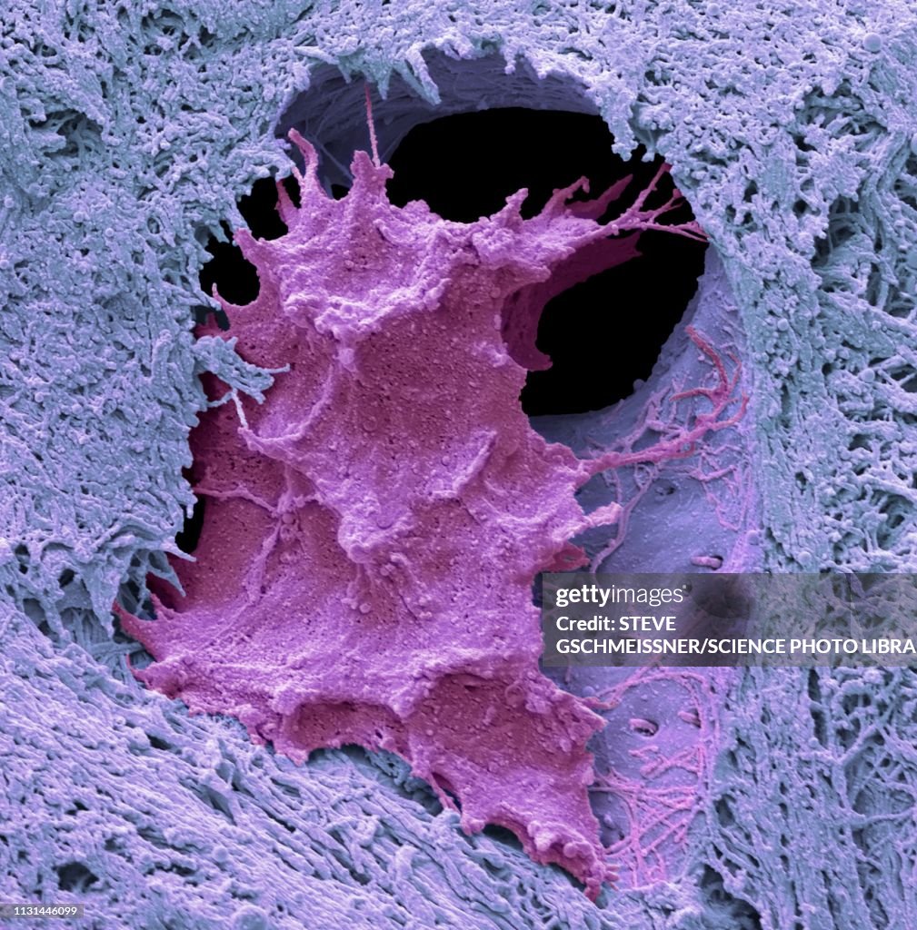 Osteocyte bone cell, SEM