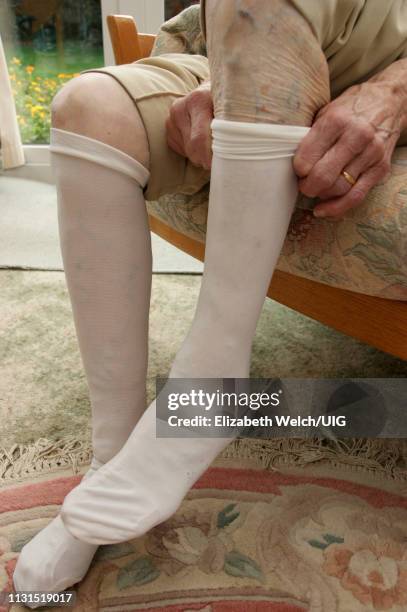 elderly woman putting on compression support stockings - compression garment stock pictures, royalty-free photos & images