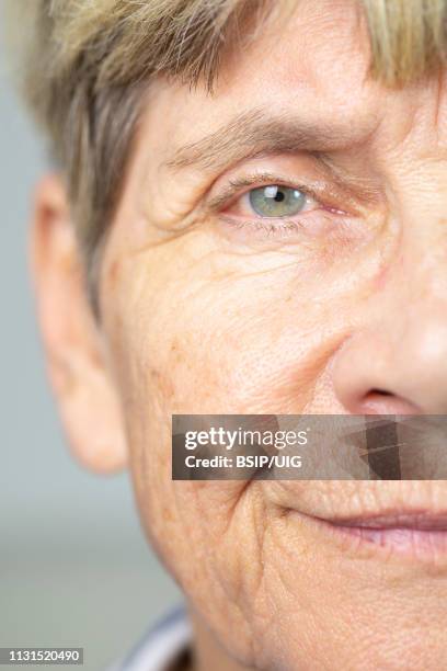 face of old woman - neuropathy stockfoto's en -beelden