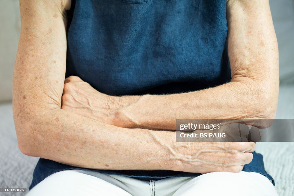 Arm of old woman