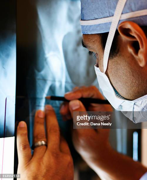 measuring for implant during orthopedic surgery - hip surgery stock pictures, royalty-free photos & images