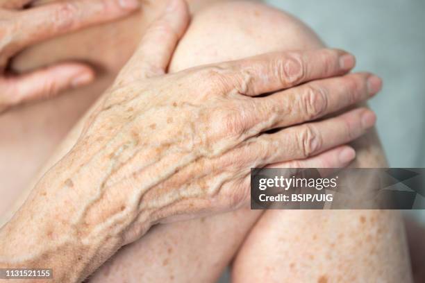 hand with spots of old age - liver spot stock pictures, royalty-free photos & images