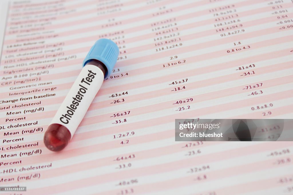Blood cholesterol test