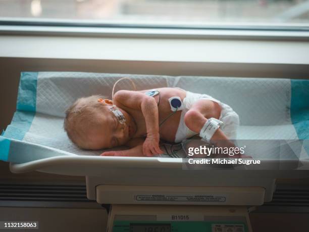 A newborn baby lies on a scale at the hospital.