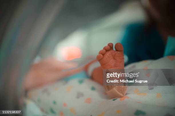 A nurse treats a baby in an isolet with hyperbillirubinemia in the neonatal intensive care unit of a hospital.