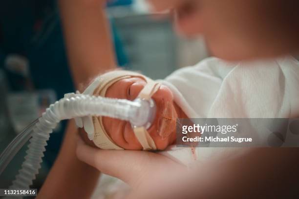 a newborn baby struggles to breathe in her mothers arms. - ventilator photos et images de collection