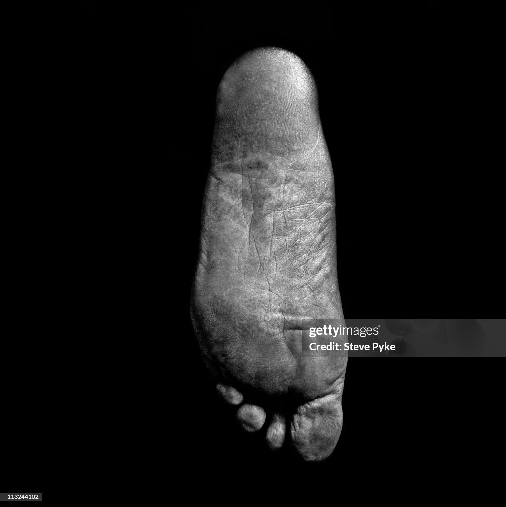 Astronaut's Foot