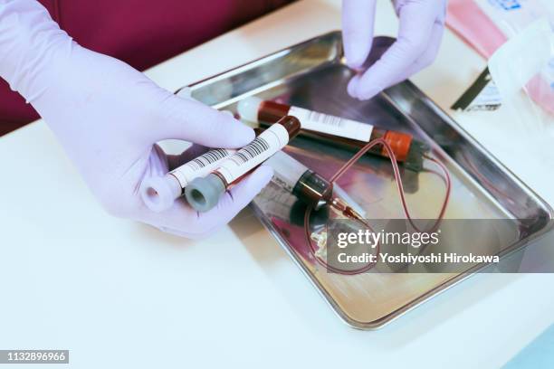 close up of syringe at hospital. - blood tubes stockfoto's en -beelden