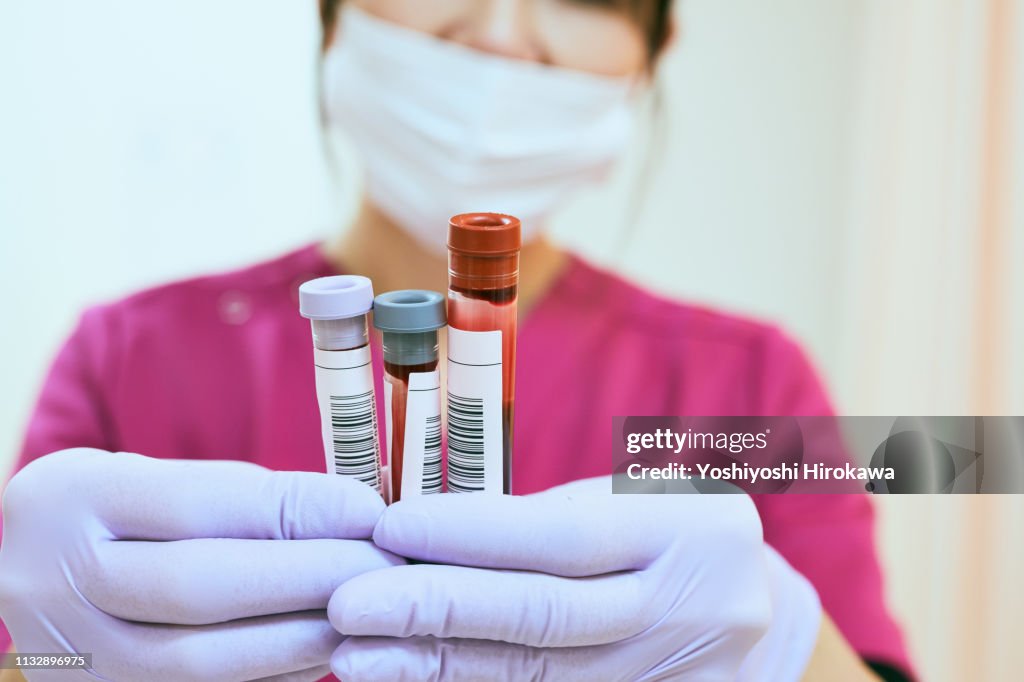 Close up of female nurse hands. She takes blood of patient in test tube at Hospital.