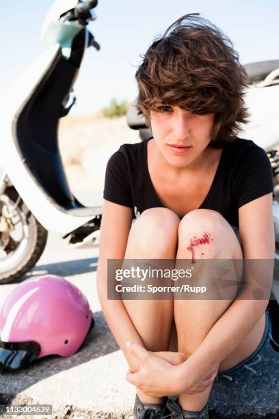woman with scooter nursing scraped knee - scraped knees stock pictures, royalty-free photos & images