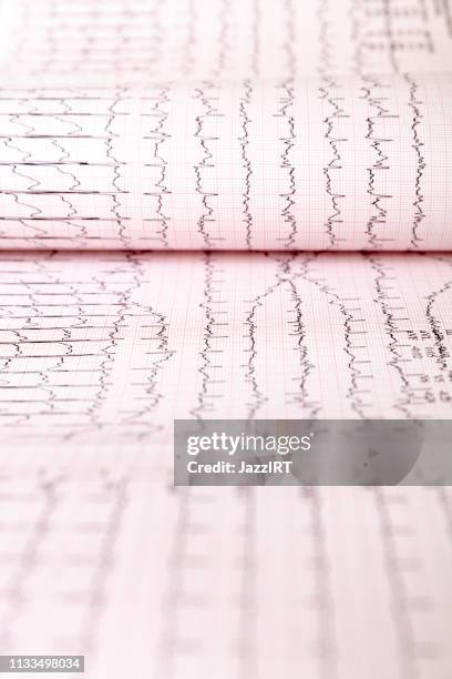 Cardiogram Chart (ECG) 이미지 (1133498034) - 게티이미지뱅크