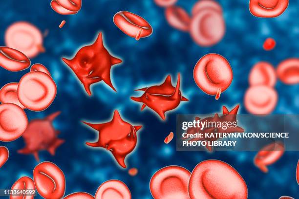 acanthocyte abnormal red blood cells, illustration - haemolytic stock illustrations