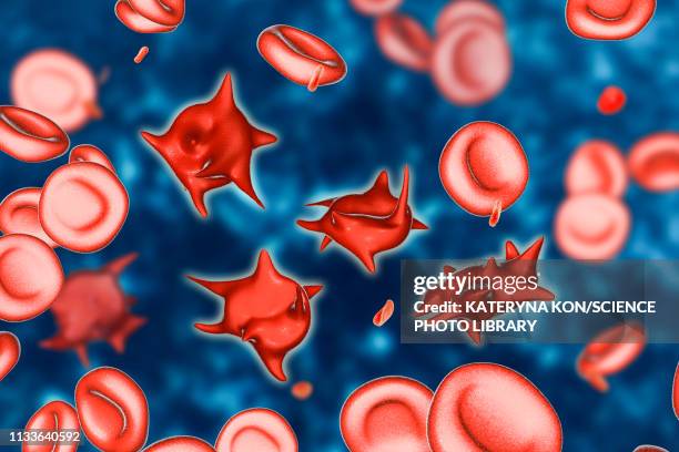 acanthocyte abnormal red blood cells, illustration - anorexia stock illustrations