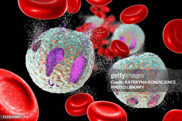 acute lymphoblastic leukaemia treatment, illustration - leukemia stock illustrations