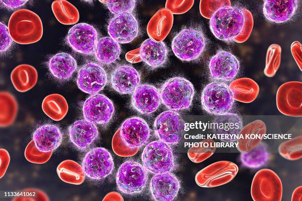 acute lymphoblastic leukaemia treatment, illustration - bone marrow tissue stock illustrations