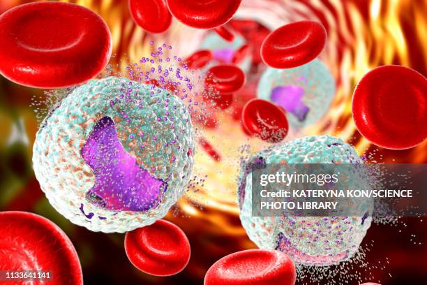 illustrazioni stock, clip art, cartoni animati e icone di tendenza di acute lymphoblastic leukaemia treatment, illustration - leucemia
