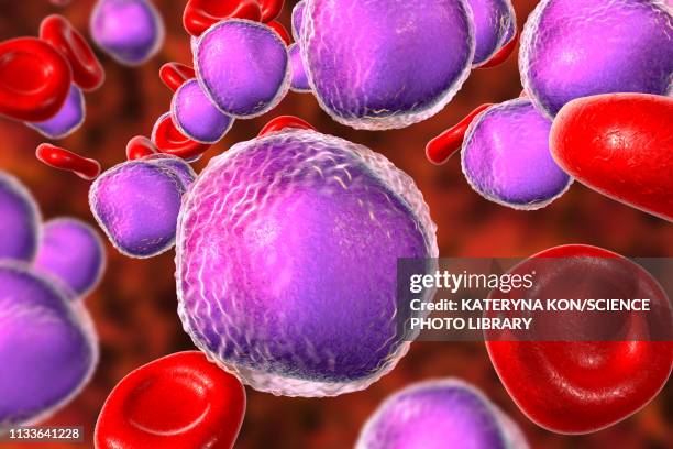 acute lymphoblastic leukaemia smear, illustration - cellular respiration stock illustrations