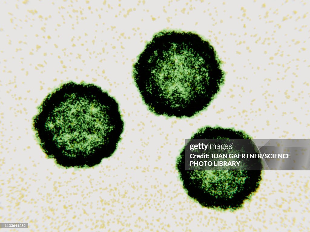 Coxsackievirus virus particles, illustration