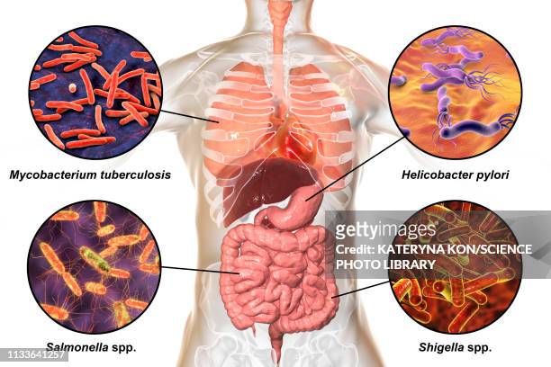 bacteria that cause human infections, illustration - helicobacter pylori stock-grafiken, -clipart, -cartoons und -symbole