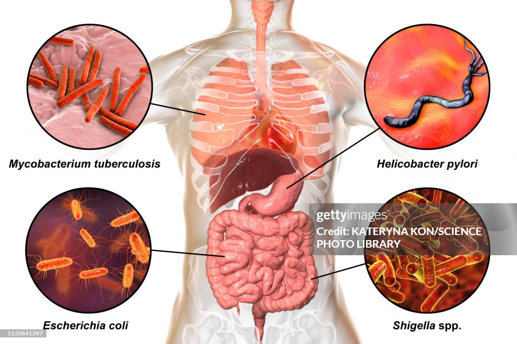 Bacteria that cause human infections, illustration
