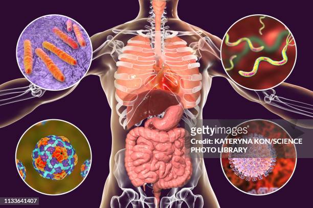 ilustraciones, imágenes clip art, dibujos animados e iconos de stock de bacteria that cause human infections, illustration - hepatitis a