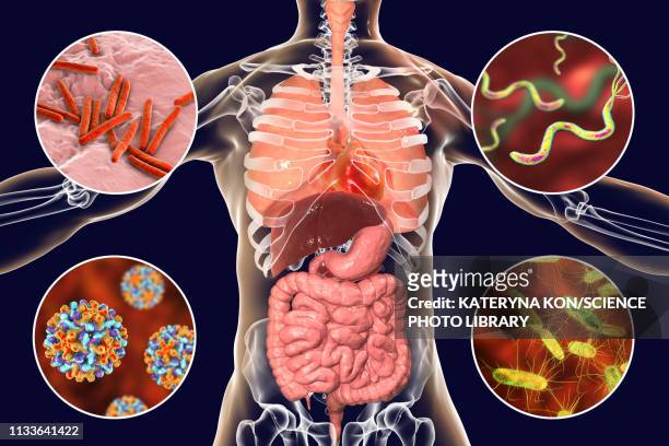 ilustrações de stock, clip art, desenhos animados e ícones de bacteria that cause human infections, illustration - eosinófilo
