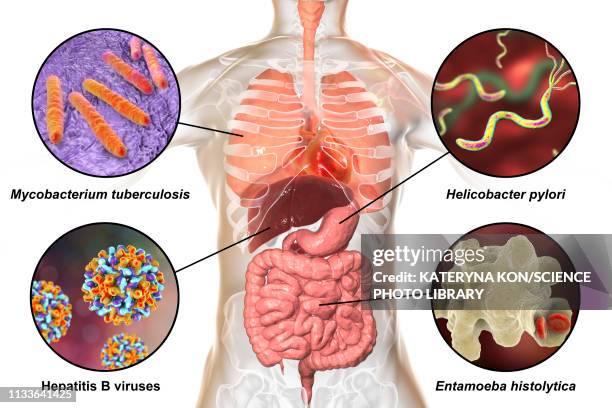 stockillustraties, clipart, cartoons en iconen met bacteria that cause human infections, illustration - amoebiasis