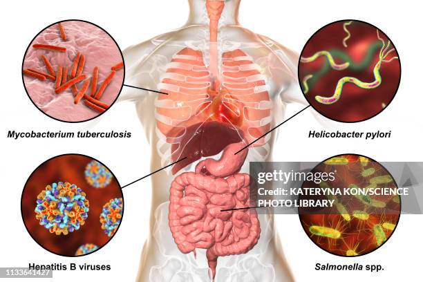 bacteria that cause human infections, illustration - hepatitis virus stock illustrations