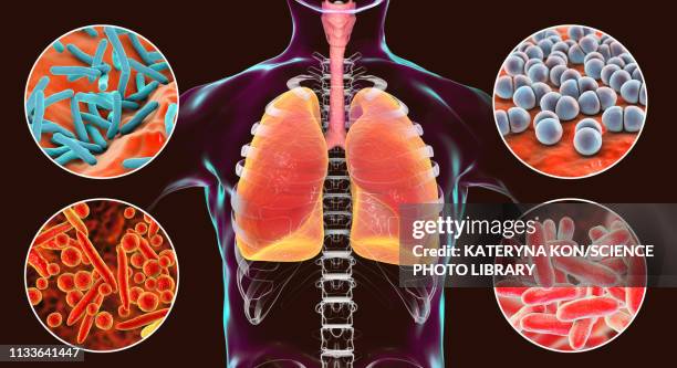 bacteria that cause lung infections, illustration - legionella stock-grafiken, -clipart, -cartoons und -symbole