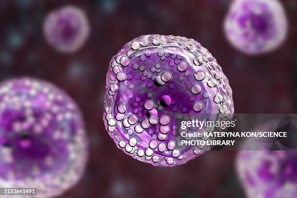 burkitt's lymphoma cells, illustration - stem cell stock illustrations