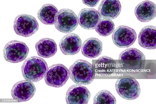 burkitt's lymphoma cells, illustration - lymphoma stock illustrations