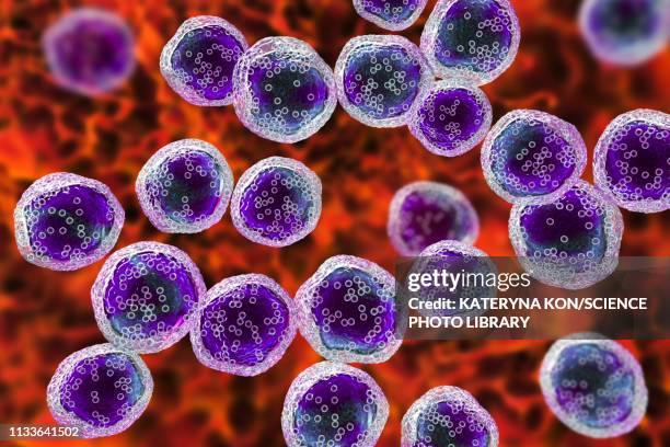 burkitt's lymphoma cells, illustration - cancer illness 幅插畫檔、美工圖案、卡通及圖標