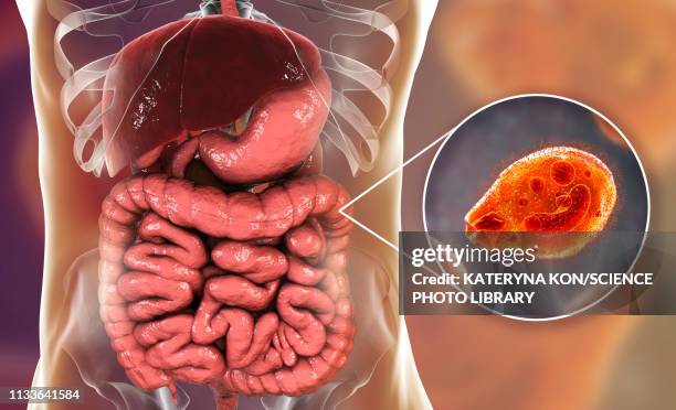 balantidiasis, conceptual illustration - balantidium stock illustrations